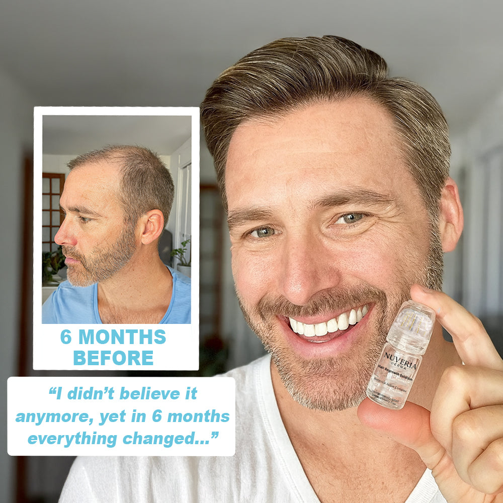 Hair Regrowth System